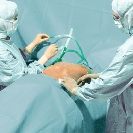 HARTMANN Foliodrape Protect Plus Neurochirurgie-Set II ung à 5 Sets